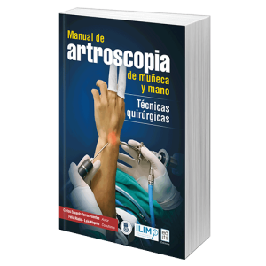 Manual de artroscopia de muñeca y mano. Técnicas quirúrgicas <br>Ebook