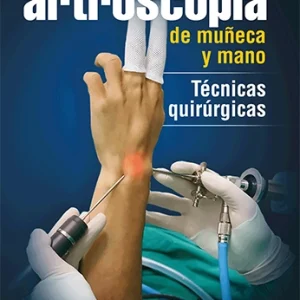 Manual de artroscopia de muñeca y mano. Técnicas quirúrgicas <br>Físico