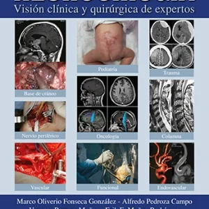 Neurocirugía. Visión clínica y quirúrgica de expertos <BR>Físico