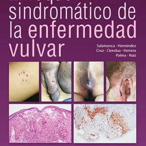 Enfoque Sindromático de la Enfermedad Vulvar<BR>Físico