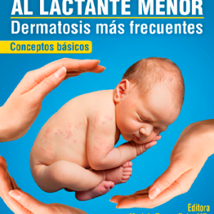 La Piel del Neonato al Lactante Menor<BR>Físico
